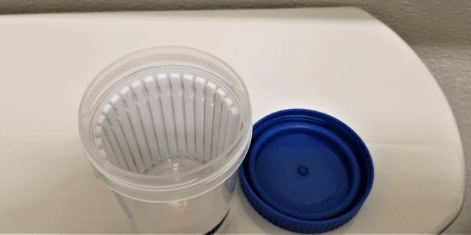 Drug testing cup used during the DOT drug testing process; failing a drug test next steps for cdl drivers; Anderson Trucking Service